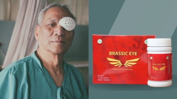 Brassic Eye: Obat Herbal Katarak yang Memberi Harapan Baru