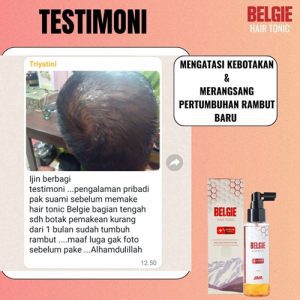 Testimoni 2: Penumbuh Rambut Alami.