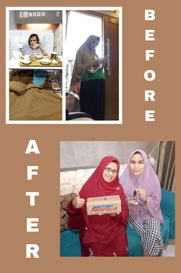 Before after penyembuhan kanker