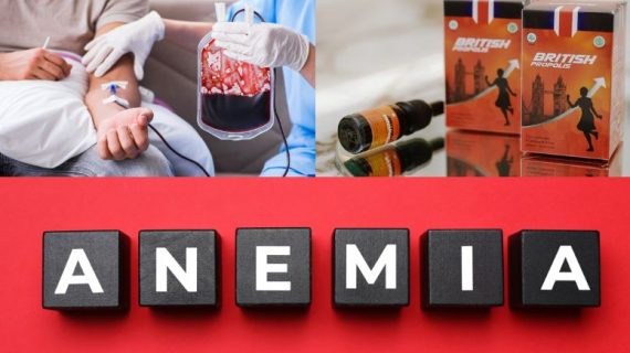 Cara Mengatasi Anemia dengan Obat Kurang Darah Herbal